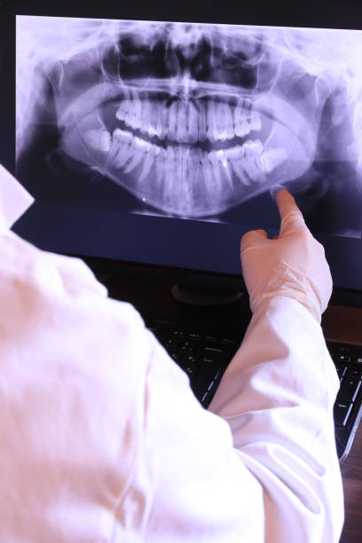 Best Emergency Treatment for Oral Infections in Ballville, OH